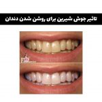 خمیر دندان جوش شیرین - تصویر 2