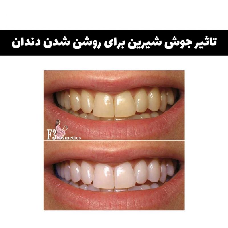 خمیر دندان جوش شیرین - تصویر 2